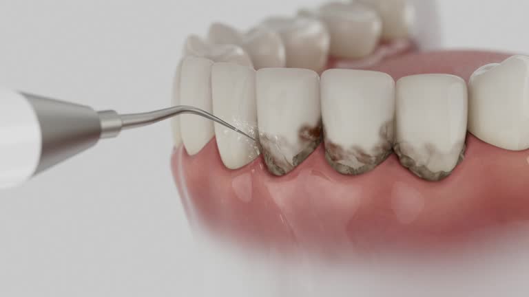 Trusted Root Canal Treatment service in Mount Hermon, CA - Dentist Open Now